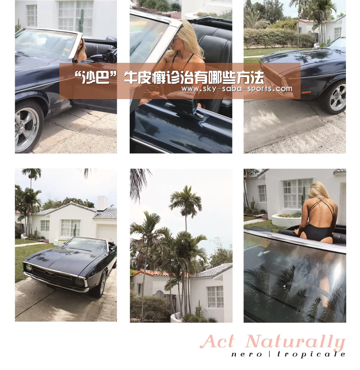 “沙巴”牛皮癣诊治有哪些方法